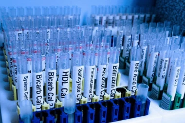 OTKRIĆE KOJE OBEĆAVA: Holandski naučnici razvijaju lek protiv koronavirusa