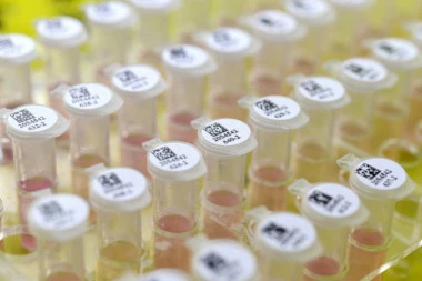 Najnovije informacije o koronavirusu: Testirani uzorci dve osobe iz Srbije!