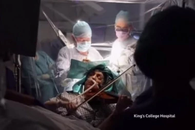 (VIDEO) Da ne poveruješ! Ovoj ženi hirurzi operišu mozak, a ona svira violinu! Zaprepašćujuće!