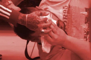 SLIKE KRUŽE INTERNETOM! Gde je ta napukla glava i silna rana? Krivična prijava protiv Baneta Čolaka zbog nameštanja telesnih povreda!