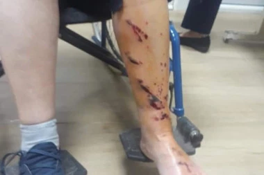 (FOTO) DNO! Krvava slika Milovog režima: Žena BRUTALNO povređena dok je čekala u redu za lek!