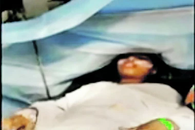 SVIRALA KLAVIR TOKOM OPERACIJE NA MOZGU: Devojčica iz Indije izdržala zahvat BEZ anestezije!