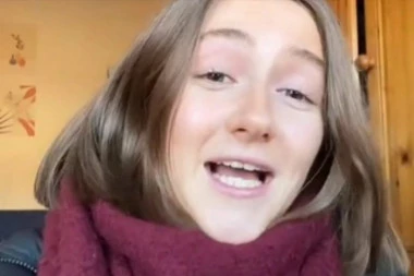 Ovu devojku je zabolelo GRLO, a nedugo zatim dobila je osip, a dijagnoza joj je LEOPARD KOŽA na koju je ona veoma PONOSNA! (FOTO+VIDEO)