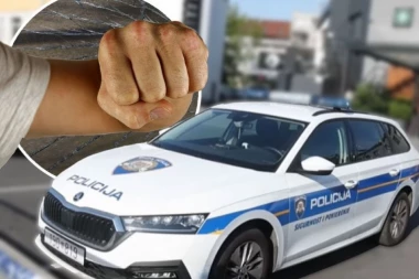 MUŠKARAC NAPAO GOSTE U KAFANI: Jedna POLICAJKA slomila nogu!