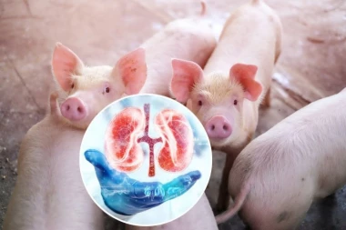 NOVI KORAK U MEDICINI! Prva uspešna transplantacija bubrega svinje u čoveka!