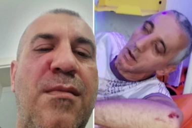 POGLEDAJTE ZASTRAŠUJUĆE FOTOGRAFIJE PRETUČENOG FUNKCIONERA SNS! (FOTO)