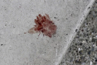 HOROR OD RANOG JUTRA! Muškarac u Prokuplju popio INSEKTICID, pa pokušao da se ZAKOLJE