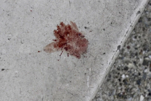 PRETUKAO MOMKA PALICOM DOK JE ŠETAO SA OCEM: Napad u Subotici, povređeni mladić u bolnici