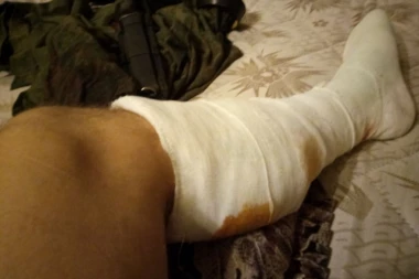 Najpoznatiji srpski borac Dejan Berić ranjen u borbi u Donbasu (FOTO)