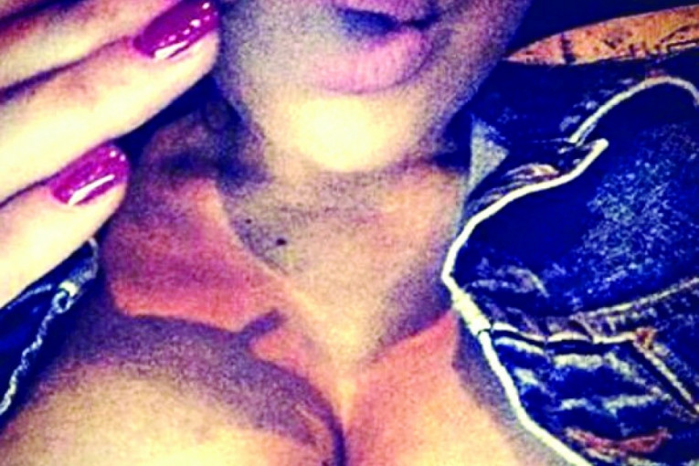 Usne pune silikona, grudi petica