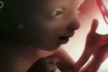 Tužila bolnicu zbog "greške": U 34. nedelji abortirala, ali je beba iznenada "oživela"?!