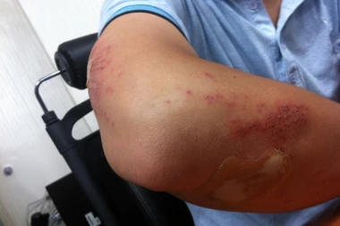 STUDENTI IZ SRBIJE NAPADNUTI U MOSTARU