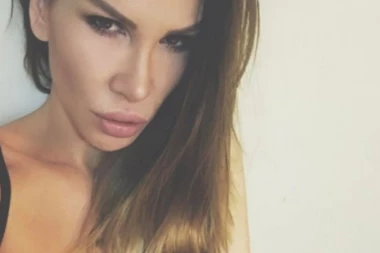 Nikolija preterala sa botoksom!