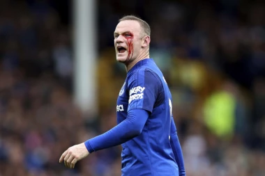 (UZNEMIRUJUĆI VIDEO) RUNIJU ŠIKLJALA KRV: Dobio lakat u oko, pa jurio sudiju po terenu!