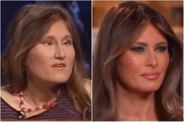 NEVEROVATNO! Divna DNK pljunuta Melanija Tramp!