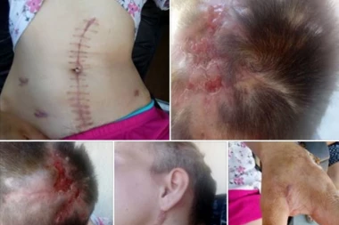 (FOTO) PRIPAŠĆE VAM MUKA: Ovako izgleda žrtva koja se opire prostituciji!