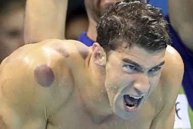 Felps govorio o dopingu!