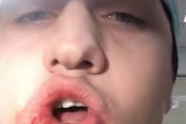 (VIDEO) Ruski zubar izvadio sam sebi zub!