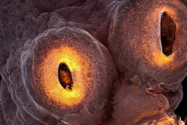 Kao jezivo biće iz dubina, A ŽIVI U VAŠEM ORGANIZMU!