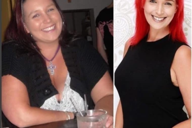 (FOTO) SMRŠALA 70 KG: Izbacila iz ishrane samo 4 namirnice