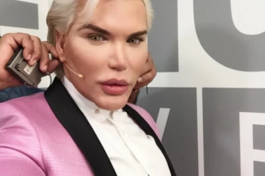 ON JE ŽIVI KEN: Potrošio pola miliona dolara na operacije