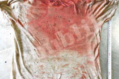 ZORAN PRAO KRV MRTVE JELENE SA SEDIŠTA U KOLIMA!