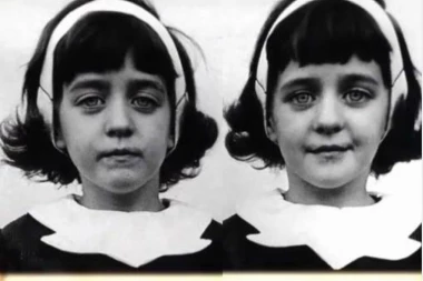 BOLESNA PRIČA O MISTERIOZNIM BLIZNAKINJAMA ĆE VAS NA SMRT PREPLAŠITI!