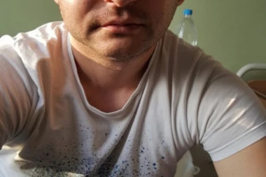 (FOTO) HOROR U NIŠKOM NASELJU DURLAN: Lopovi zverski pretukli domaćina