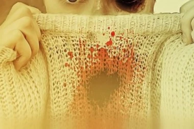 SRBIN POLIO DEVOJKU KISELINOM PO LICU NASRED BEČA!