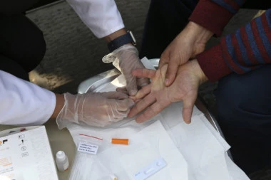 SVETSKI DAN AIDS! U Srbiji od januara do novembra 55 inficiranih, najmlađa osoba ima samo 19 godina!