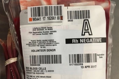 UŽAS U VOJVODINI: PRIMILA KRV, PA SE INFICIRALA HIV-om