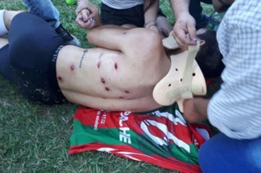 (FOTO, VIDEO) UZNEMIRUJUĆI SADRŽAJ: Policija pucala na fudbalere gumenim mecima, jedan je umalo ostao bez oka!