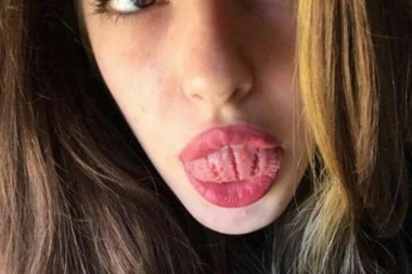 "Ruski lekar" otkriva: JEZIK JE OGLEDALO ZDRAVLJA