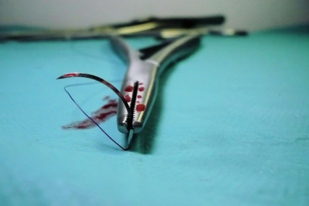 PRODAJU ORGANE BOGATAŠIMA: Evo koliko KOŠTA BUBREG na crnom tržištu!