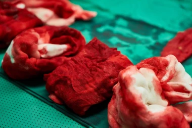 DRAMA U NEGOTINSKOM PORODILIŠTU: Doktora UJELA porodilja zaražena HEPATITISOM B