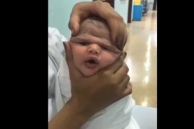 (UZNEMIRAVAJUĆI VIDEO) MEDICINSKI MONSTRUMI: Krvnički stiskale bebi glavu, pa popile otkaz!