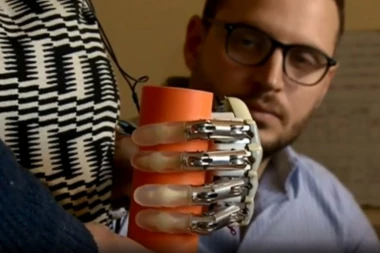 Napravljena bionička ruka koja omogućava pravi osećaj dodira