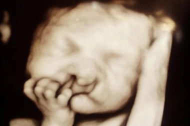 HRABRA ŽENA PODARILA ŽIVOT: Savetovali su da pobaci zbog hendikepiranog ploda, ali nije se dala - pogledajte ovog lepotana!