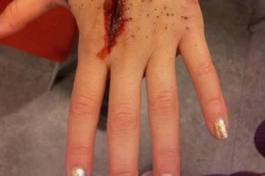 (FOTO) Jeleni Marjanović na silu skinuta burma pre ubistva, A EVO ČIJI DNK JE PRONAĐEN NA NJENOM PRSTU!