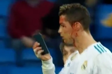 (VIDEO) Ronaldo pogađao, a se onda krvav ogledao na mobilnom telefonu