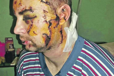 POLICAJCA KASAPIO FLAŠOM