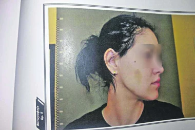 (FOTO) SNAJU DRŽAO POD KLJUČEM, pa je brutalno pretukao!