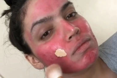 (VIDEO) RIJANINA ŠMINKA ČINI ČUDA: Puder poznate pevačice pokriva apsolutno svaku tačku na licu!