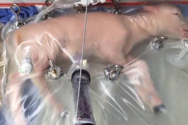(VIDEO) NOVO OTKRIĆE UZDRMALO ČOVEČANSTVO: Fetus se razvio u veštačkoj materici