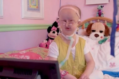 (FOTO) Mišel ima sindrom, koji pogađa jednu osobu u pet miliona! Srećna je i želi da bude dizajnerka