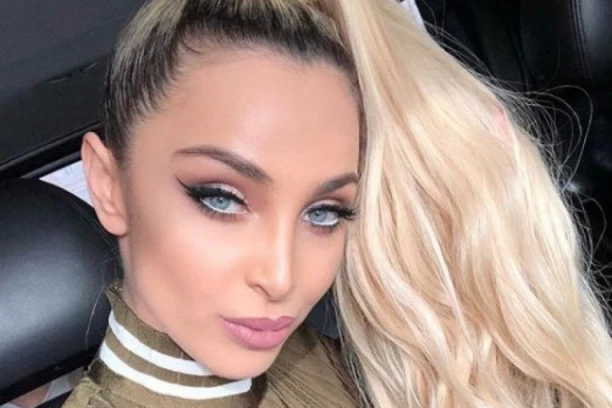 PROGOVORILA O ESTETSKIM OPERACIJAMA: Maja Berović nabrojala šta je sve promenila na sebi!