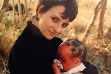 BEBA JE ROĐENA SA KOŽOM CRVENOM KAO RAK: Decenijama kasnije otkriven je užasan problem koji ima