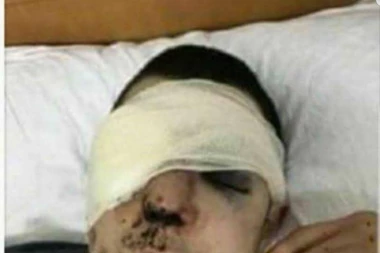 POLICIJA GLEDALA brutalni napad u Kumanovu: DRŽAVLJANINA SRBIJE PREMLATILI ALBANCI!