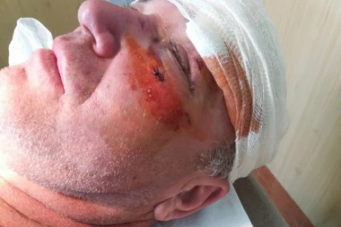 (FOTO) SKANDAL: BATINAŠI VUKA JEREMIĆA PRETUKLI ČLANA SNS!!!