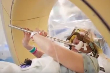 (VIDEO) NEVEROVATNO: Žena svira flautu, dok joj OPERIŠU MOZAK